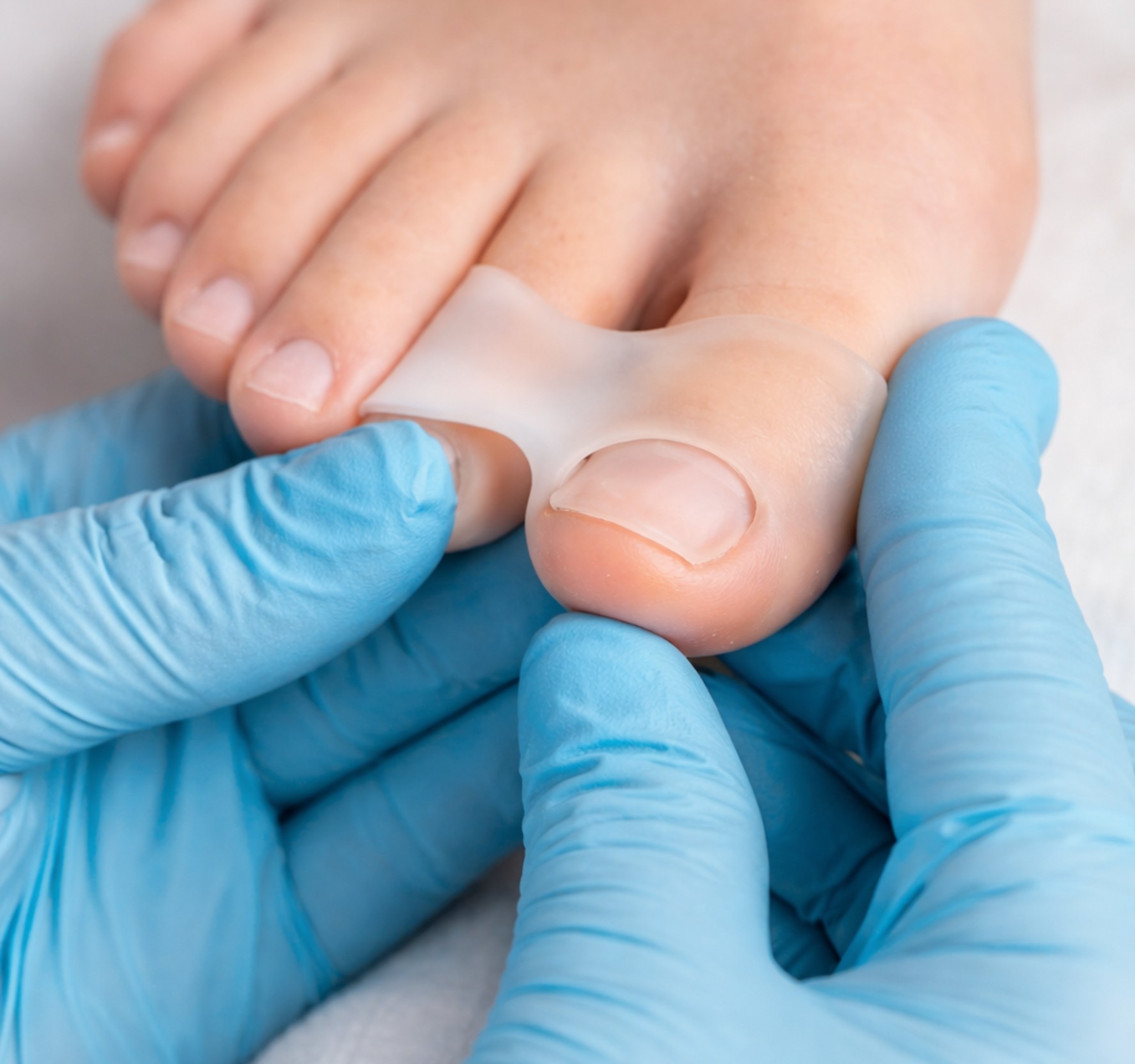 Podologie Jena – Druckentlastung